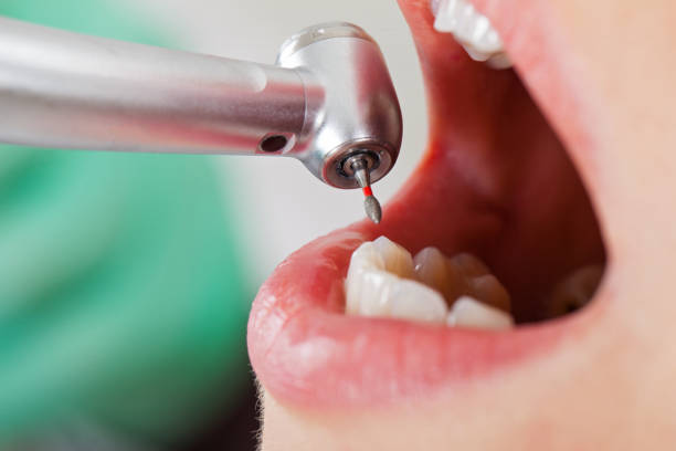 Best Walk-In Emergency Dentist in Waldron, AR